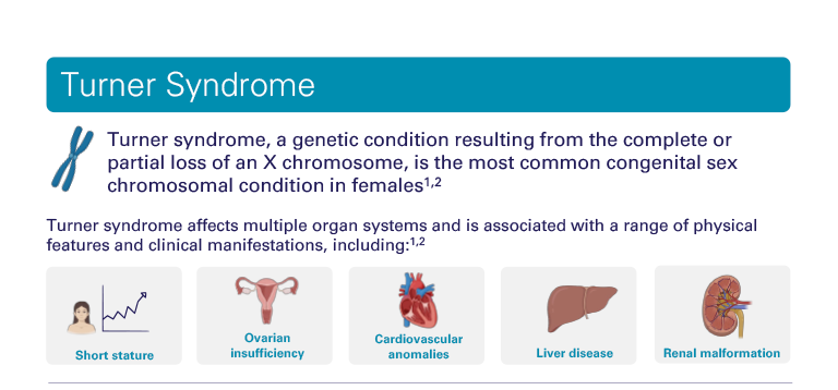Turner Syndrome Overview